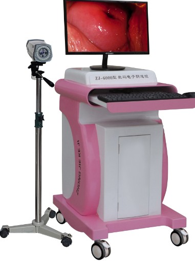 数码电子阴道镜