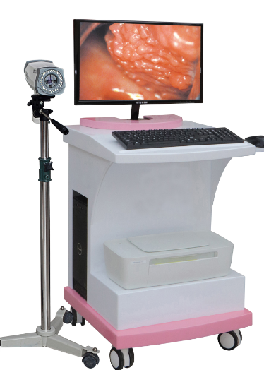 数码电子阴道镜（旗舰型）